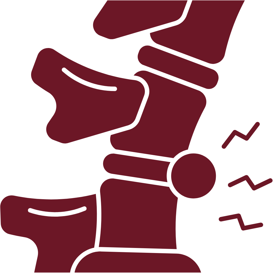 Herniated/Bulging Disc