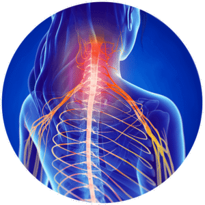 Pinched Nerve Relief in Ahwatukee, AZ