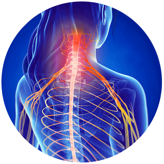 Pinched Nerve Relief in Ahwatukee, AZ