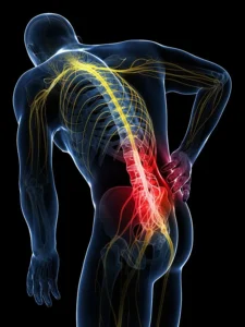 Pinched Nerve Relief in Ahwatukee, AZ