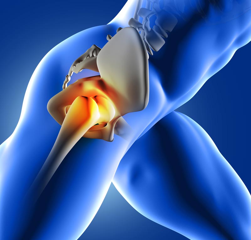 Hip Pain Relief in Ahwatukee, AZ