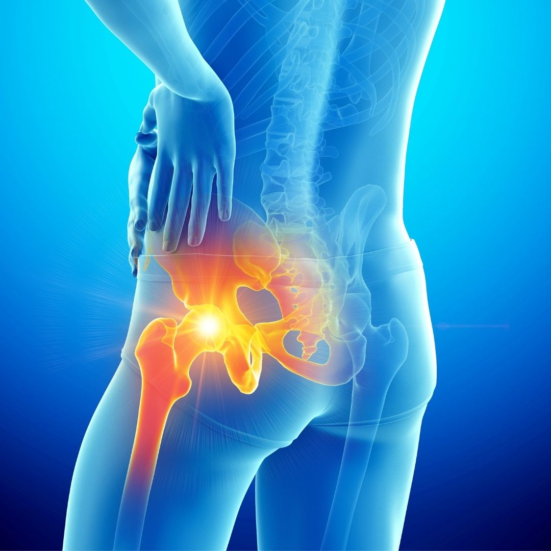 Transparent x-ray image of a person clutching their hip, showing highlighted red inflammation in the sacroiliac joint area, indicating pain or discomfort.